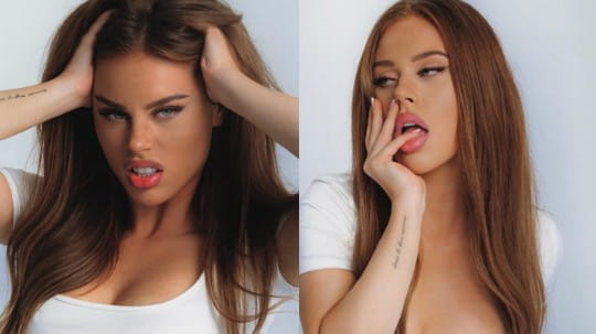 Как Екатерина Горина переживает период восстановления после пластической операции